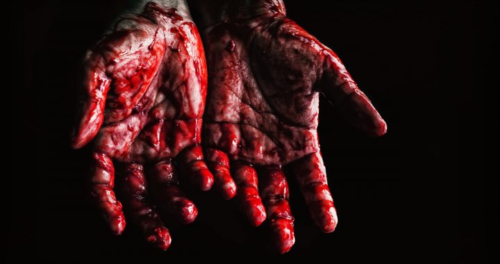 hands covered in blood
